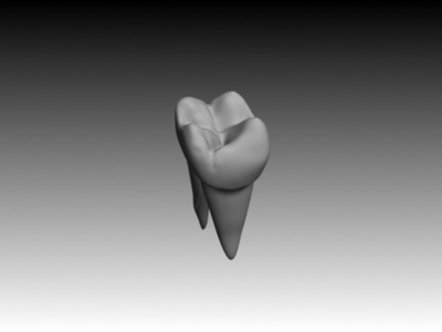 右上颌第一磨牙雕刻图图片